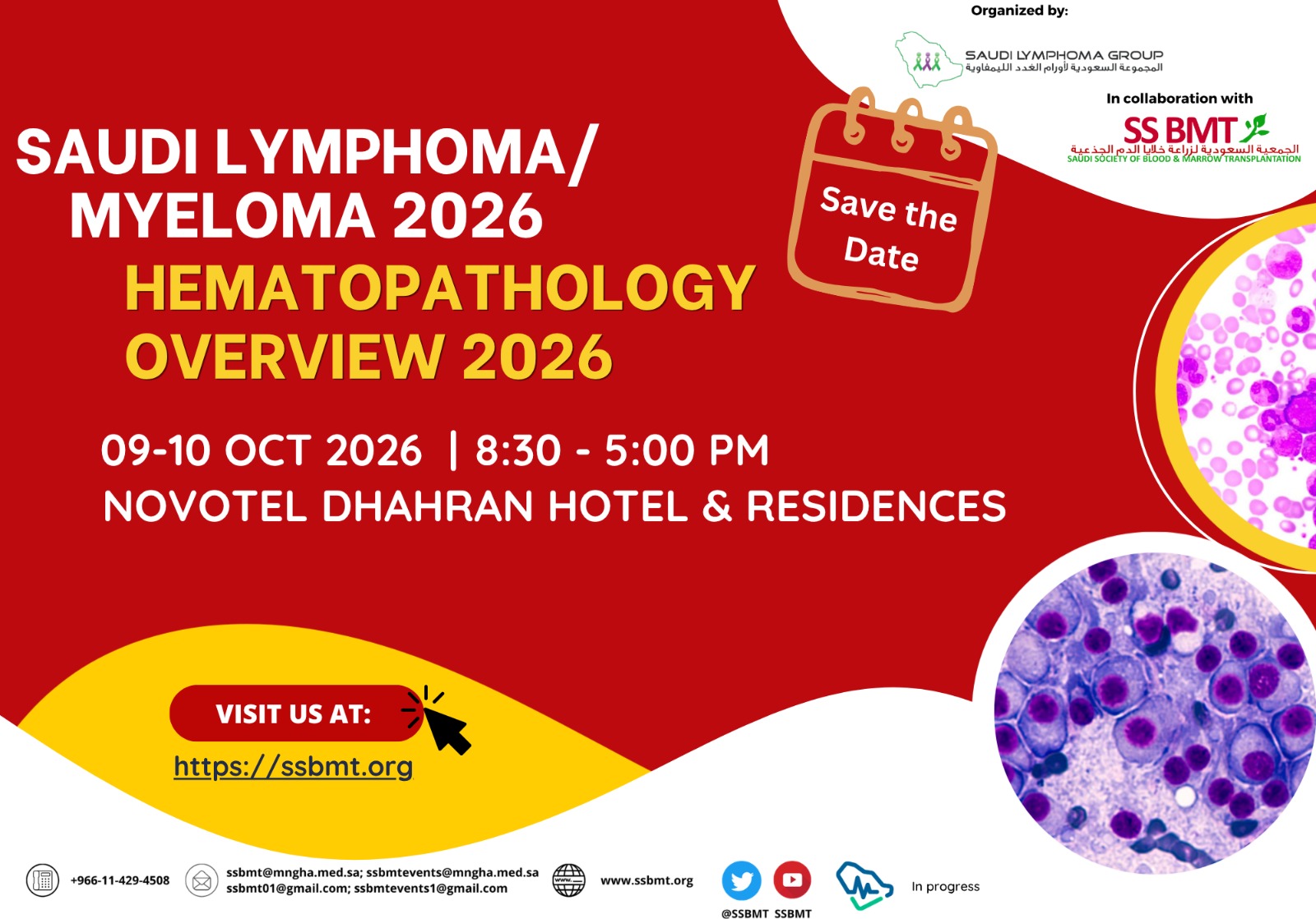 Saudi Lymphoma/Myeloma Hematopathology Overview 2026 poster
